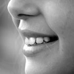 【前歯のインプラント治療】抜歯即時埋入法の経過リアルな感想②